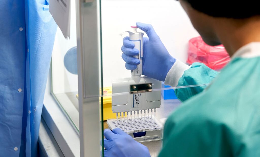 ΗΠΑ : Πολλαπλάσιος ο πραγματικός αριθμός των κρουσμάτων κοροναϊού
