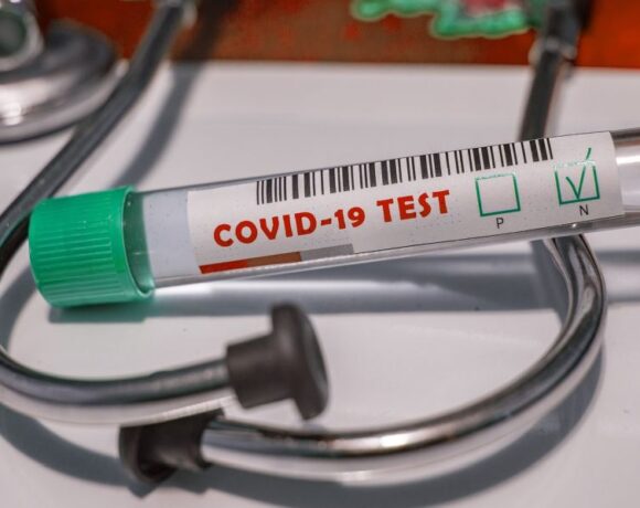 Greece Preparing For Possible Covid 19 Cases ‘entering’ Via Travel