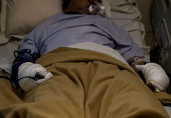 Κοροναϊός : Δεύτερη πιο πληγείσα χώρα η Ινδία – Ξεπέρασε τα 4 εκατ