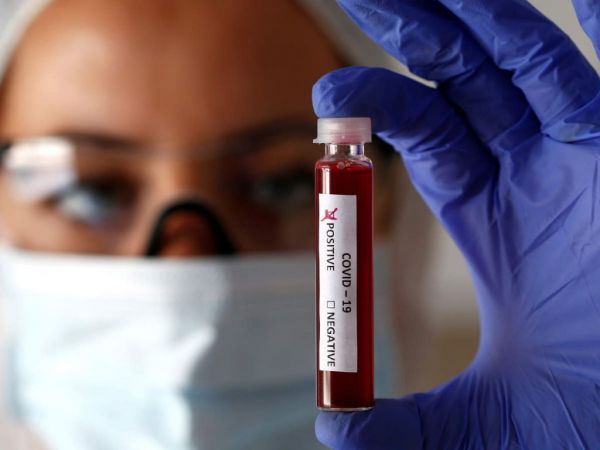 «Πόλεμος» επιδημιολόγων για τα Lockdown – Φουντώνει η συζήτηση για τον κοροναϊό