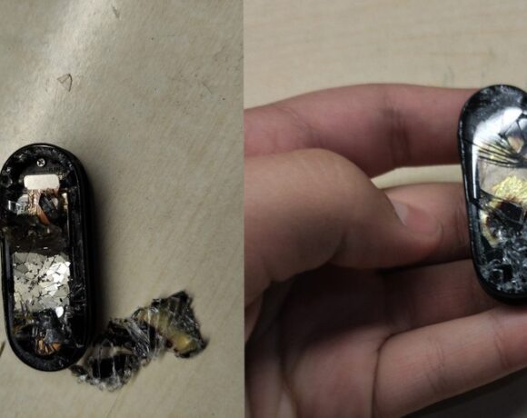 Xiaomi Mi Band 5: Έπιασε φωτιά ενώ ήταν στη φόρτιση