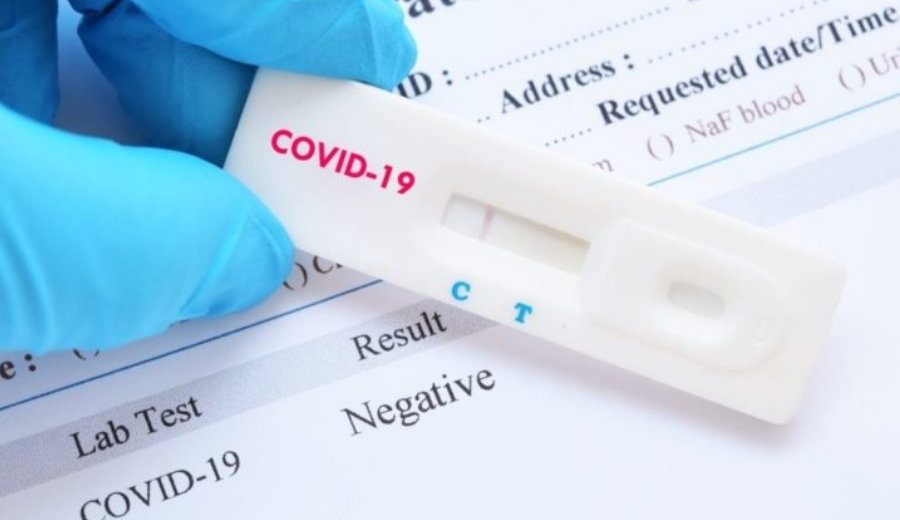 Παρέμβαση ΓΓΑ για τα μοριακά τεστ στη βόλεϊ λιγκ