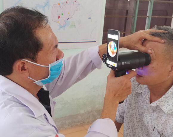 Galaxy Upcycling: Παλιά Smartphones χρησιμοποιούνται για διάγνωση οφθαλμολογικών παθήσεων