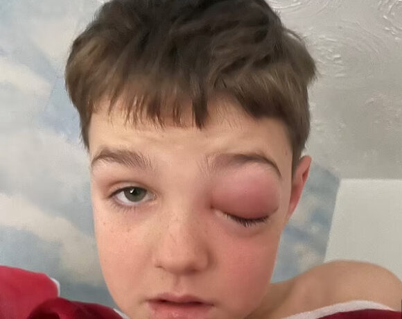 Κοροναϊός – Σπάνια παρενέργεια σε 9χρονο – Παραλίγο να τυφλωθεί