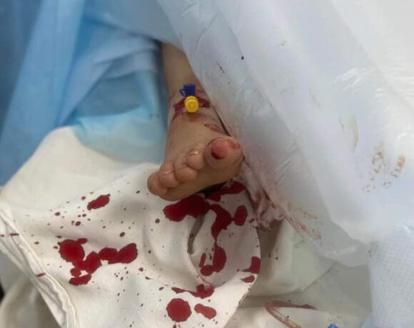 Πόλεμος στην Ουκρανία: Δραματικές ώρες στο Κιέβο – Χτυπήθηκε νοσοκομείο, ένα παιδί νεκρό
