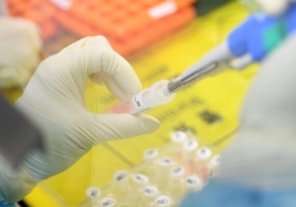 Kορωνοϊός: Επιστήμονες δημιούργησαν Pcr που ανιχνεύει τον ιό μέσα σε λίγα λεπτά