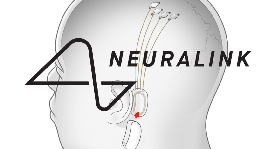 Neuralink: Κατηγορείται για πειράματα – βασανιστήρια σε πιθήκους