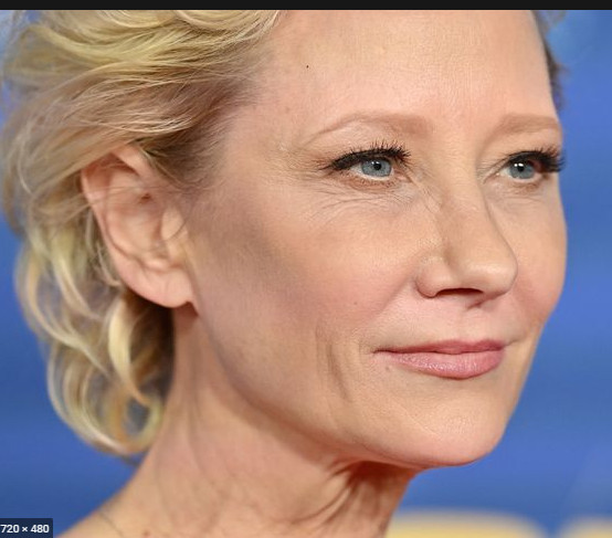 Αν Χεκ: Νεκρή η ηθοποιός, την αποσυνέδεσαν από το μηχάνημα υποστήριξης