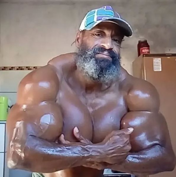 Πέθανε σε ηλικία 55 ετών ο Βραζιλιάνος «Hulk» – Έκανε ενέσεις λαδιού για να «φουσκώσει» τους μύες του