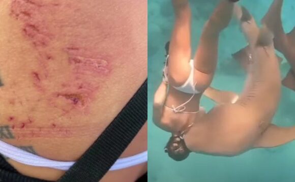 Μαλδίβες: Στιγμές τρόμου για κολυμβήτρια – Τη δάγκωσε καρχαρίας 100 κιλών