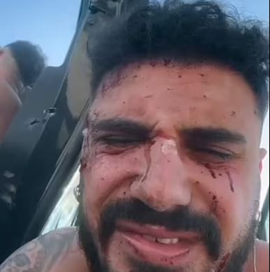 Ισραήλ: 28χρονος περιγράφει πώς επέζησε από τη σφαγή στο μουσικό φεστιβάλ